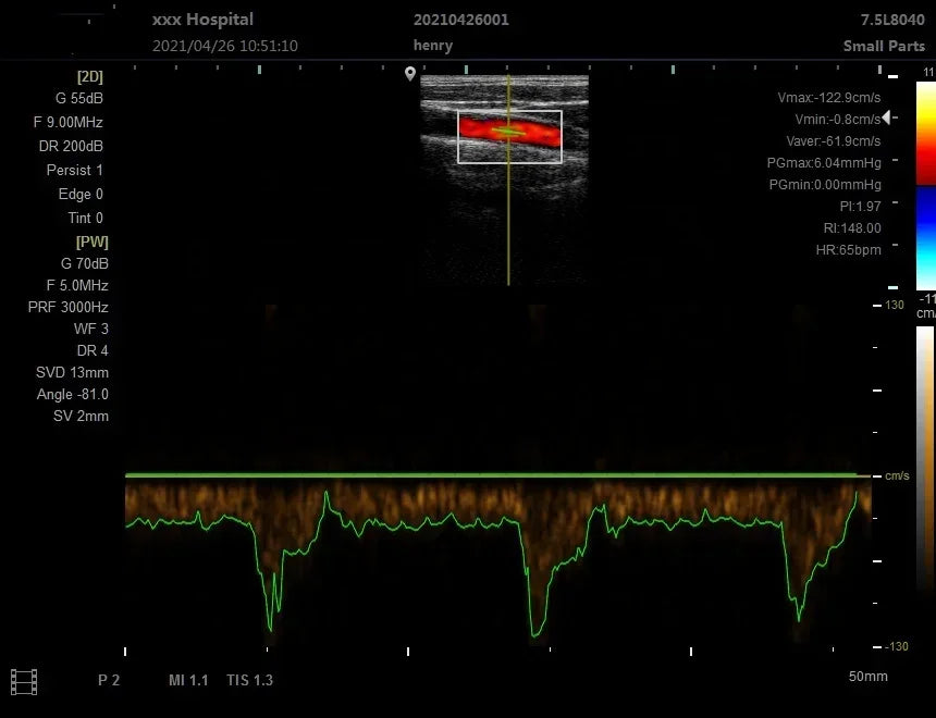 3D Color Doppler Small Big Animal Veterinary Pet Notebook Ultrasound Diagnostic Echo Machine