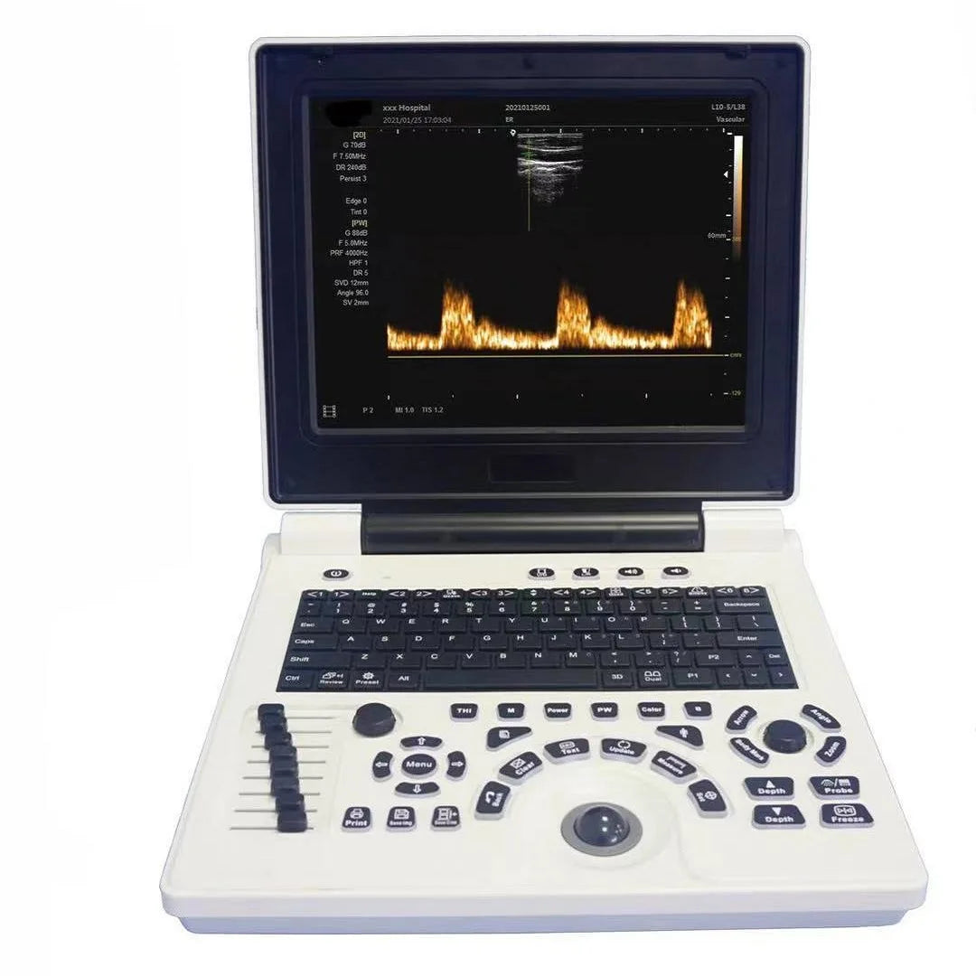 Veterinary Ultrasound Scanner | Portable High-Precision Animal Diagnostic Machine