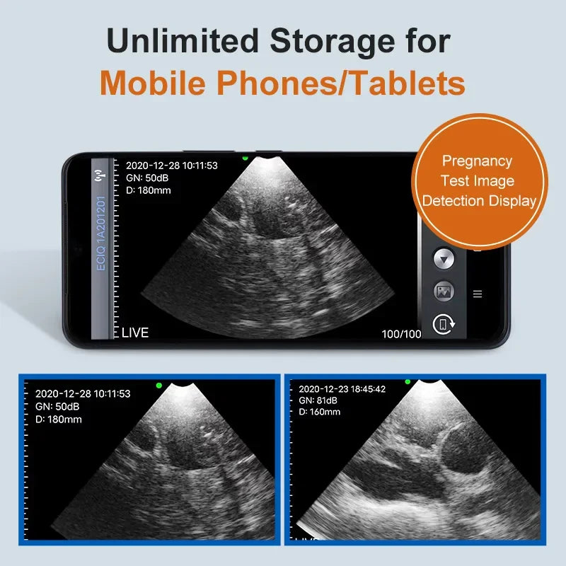 Wireless Veterinary Ultrasound Scanner New Portable Mechanical Pregnancy Test Handheld Ultrasound Machine Pig Sheep For Andorid