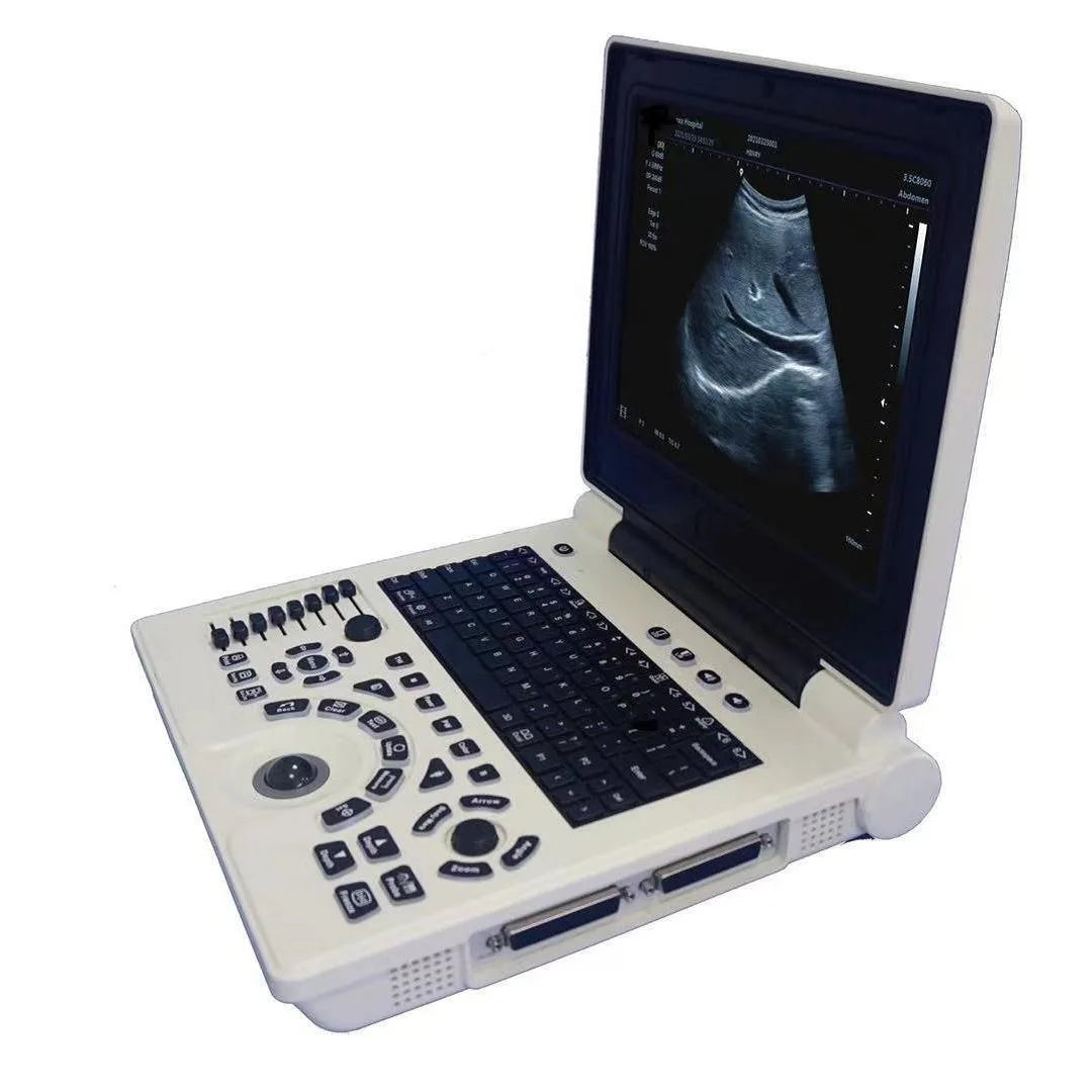 Veterinary Ultrasound Scanner | Portable High-Precision Animal Diagnostic Machine