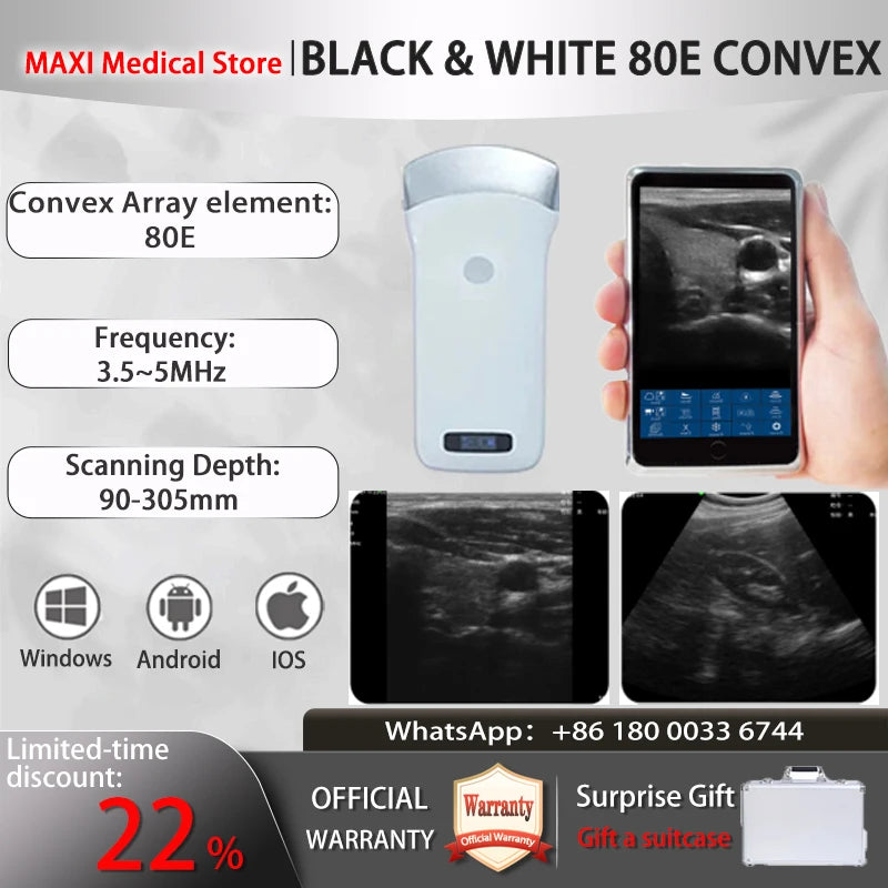 Portable Wireless Ultrasound Probe scanner machine WIFI ultrasound scanner Machine support iOS Android Windows free suitcase