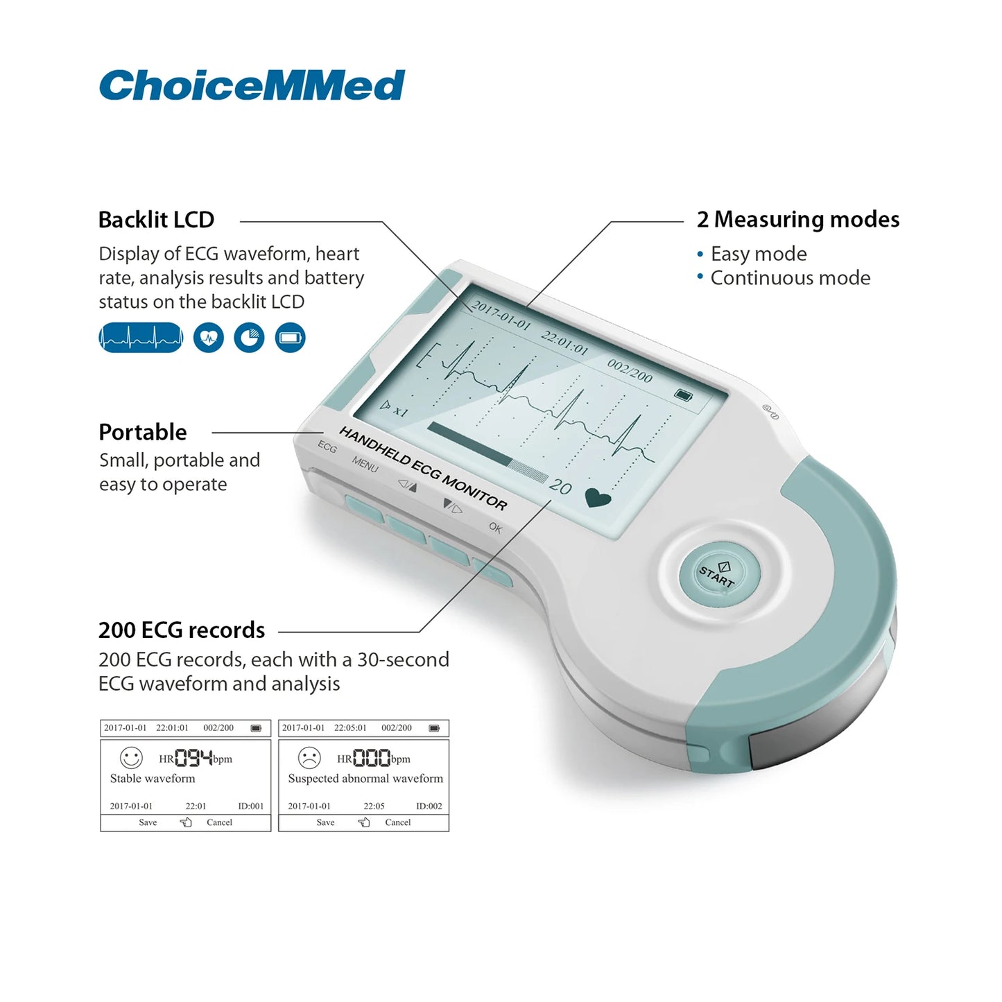 ChoiceMMed Handheld ECG Monitor EKG Real-time Monitoring Of Heart Rate Holter Continuous Measurement Electrocardiogram