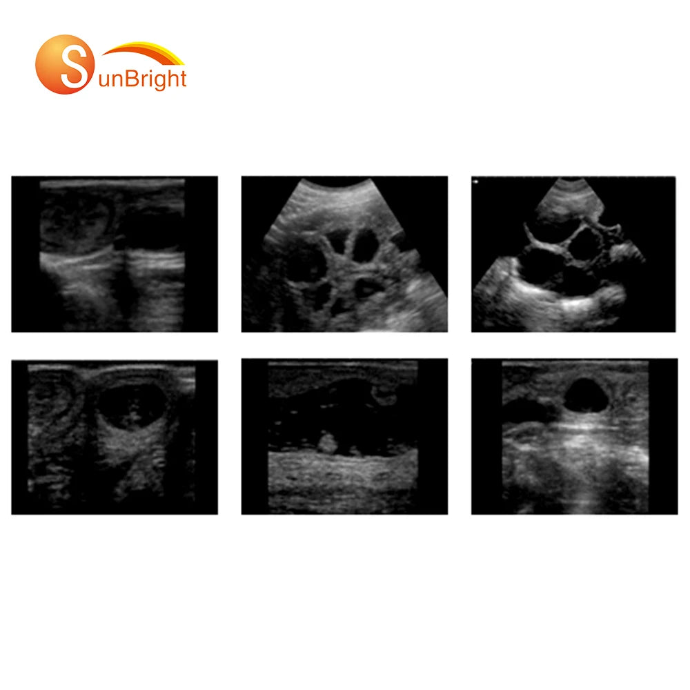 B&W Ultrasound Machine Medical Diagnostic Imaging Equipment Cheapest Portable 2d Ultrasound Scanner Veterinary Use