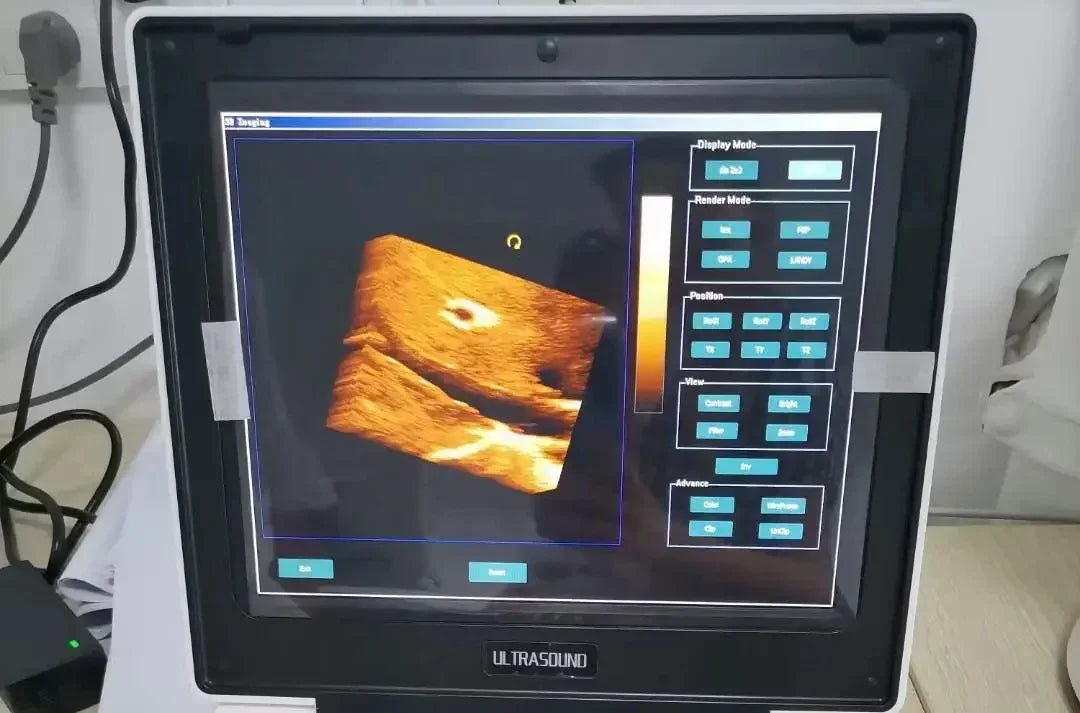 3D Color Doppler Small Big Animal Veterinary Pet Notebook Ultrasound Diagnostic Echo Machine