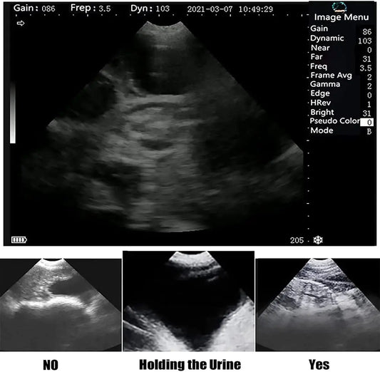 Portable Ultrasound Veterinary M10 Handheld Laptop Test Uterine Disease Pregnancy Scanner Ge Machine